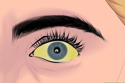 How to Know if You Have an Enlarged Liver