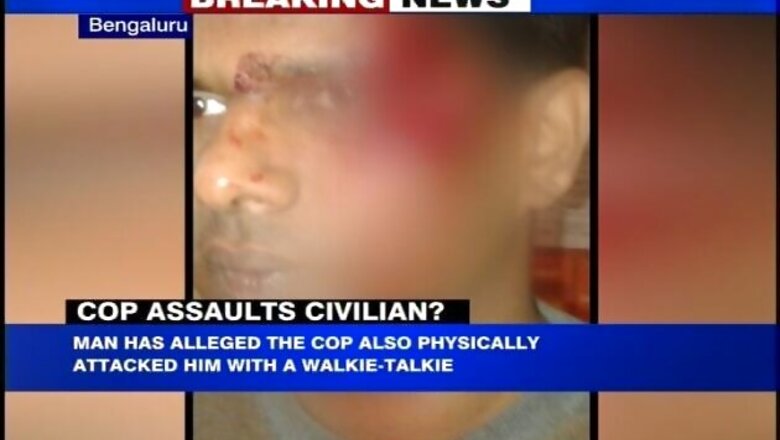 Bengaluru: Biker alleges attack by a traffic policeman