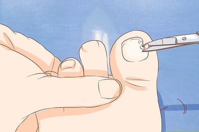 How to Help a Toenail Grow Back Quickly
