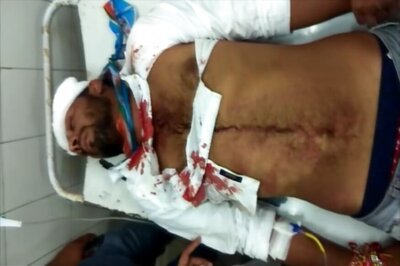 Violence Rocks Rajasthan University Ahead of Student Union Polls; NSUI Candidates Injured