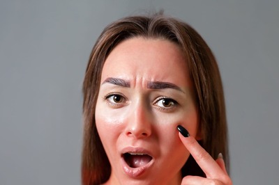 Experts Suggest These Tips to Protect Yourself from Sunburn and Heal Burn Scars