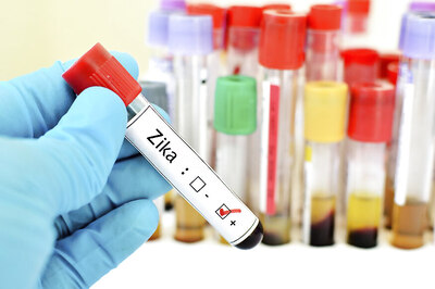 2 Persons Who Tested Positive For Zika Die in Madhya Pradesh, 109 Affected in State