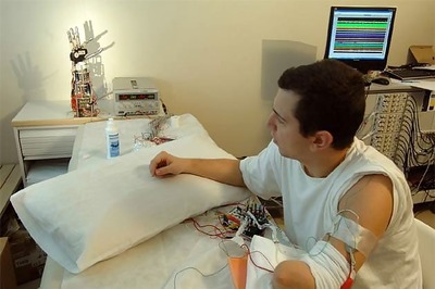 World's first artificial hand allows patients to feel touch