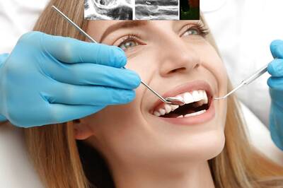 How wearing aligners might affect your daily lifestyle