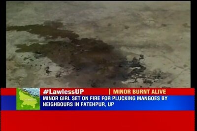 UP:  Minor girl allegedly set on fire by neighbours in Fatehpur