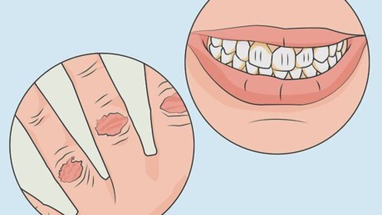 How to Diagnose and Treat Purging Disorder