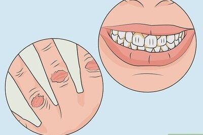 How to Diagnose and Treat Purging Disorder