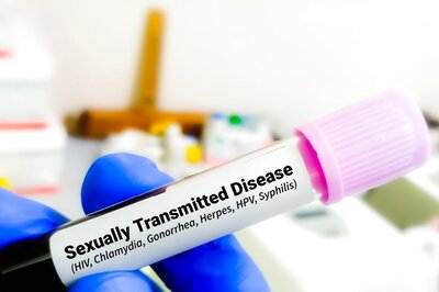 Could HIV AIDS Treatment Become 1,000 Times Cheaper? Here's What Recent Revelations Suggest