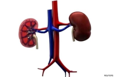 High BP, if uncontrolled, can affect kidney: Dr Sanjay K Agarwal