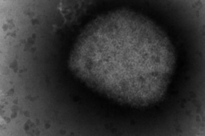 Global Monkeypox Soar: Is It Airborne? Can Pregnant Women Pass It To Unborn Fetuses? | Top Points