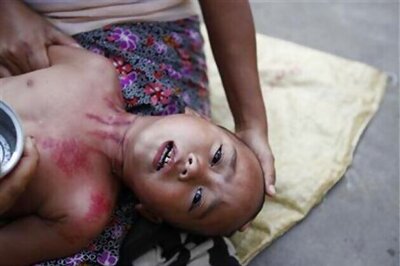 Malaria claims 76 lives in Tripura