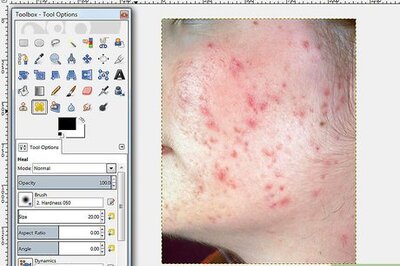 How to Remove Facial Blemishes on GIMP