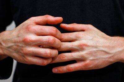 Autoimmune Disorder: Symptoms, Causes, Treatment, Impact of COVID-19 and More