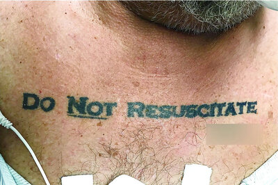 Patient's ‘Do Not Resuscitate’ Chest Tattoo Stumps Florida Doctors