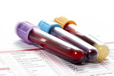Inflammation in Midlife Linked to Brain Shrinkage Later