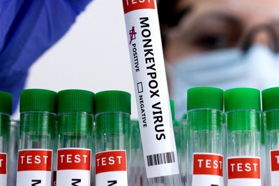 What Sexually Active People Need to Know About Monkeypox