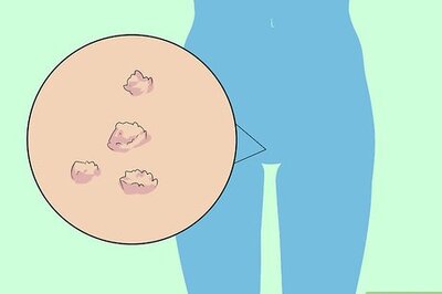 How to Recognize HPV in Women (Human Papillomavirus)