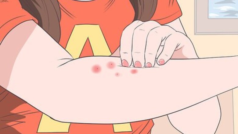 How to Diagnose ITP