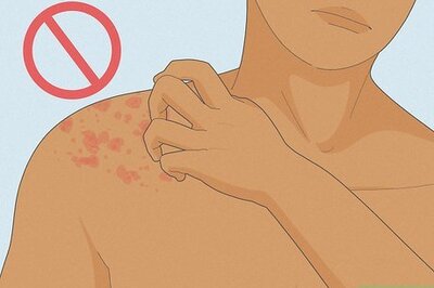 How to Treat Nerve Pain Caused by Shingles