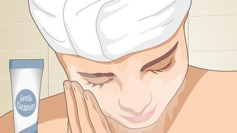 How to Prevent Acne Naturally