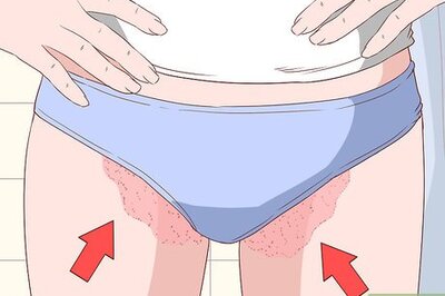 How to Know if You Have Jock Itch