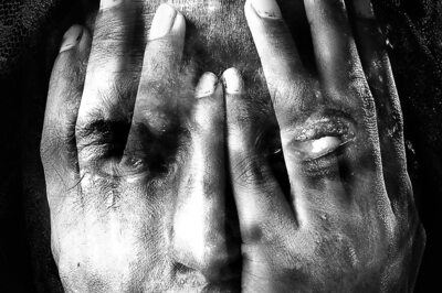 19-Year-Old Woman Throws Acid on Boyfriend for Rejecting Her Marriage Proposal in Aligarh