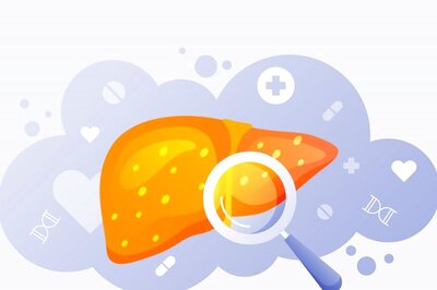 World Liver Day 2023: All You Need To Know About Liver Cirrhosis