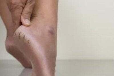 Home Remedies To Get Rid Of Cracked Heels And Get Perfectly Soft Heels