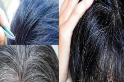 Treat Your Premature Grey Hair With These Home Remedies 