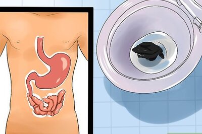 How to Treat Bloody Stools