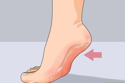 How to Get Rid of Cracked Heels Fast