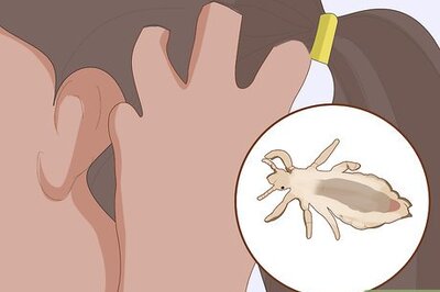 How to Prevent Lice