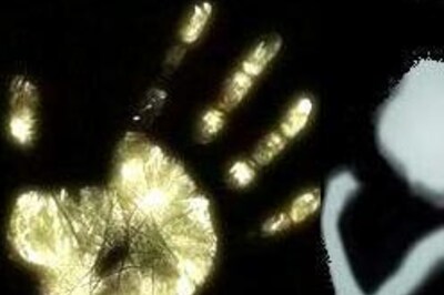 Angry teacher inserts pin in Class 2 girl's eye