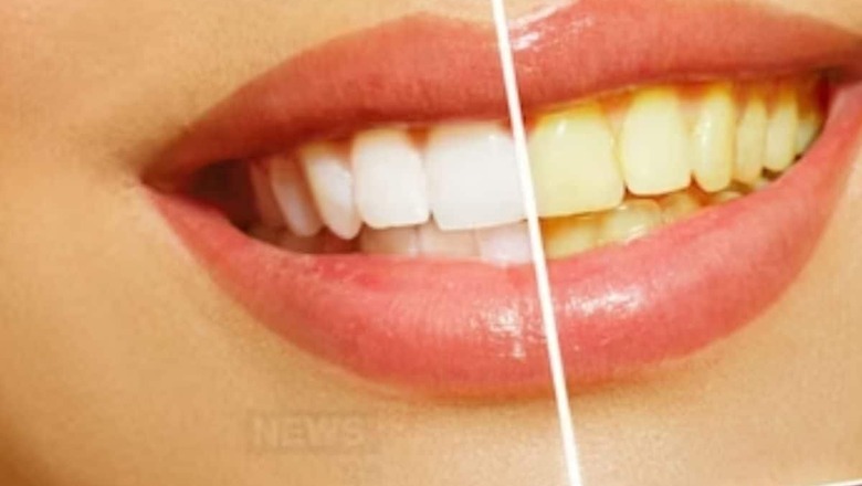 Unlocking Your Smile's Potential: Banish Teeth Stains with These Remedies