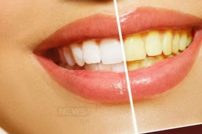 Unlocking Your Smile's Potential: Banish Teeth Stains with These Remedies