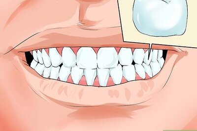 How to Avoid Dental Crown Problems