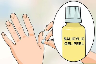 How to Get Rid of Warts on Fingers