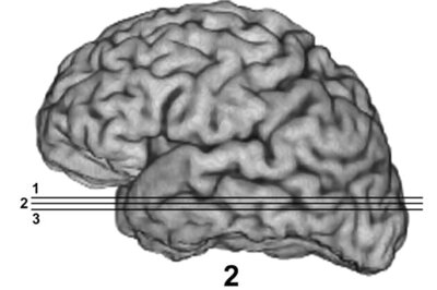 Women have more resilient brains: Study