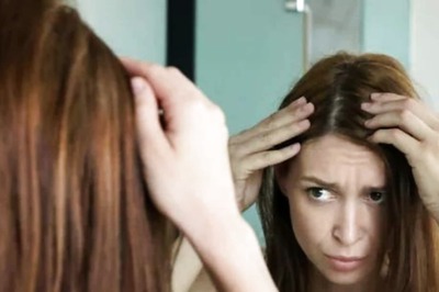 7 Ways To Deal With Dandruff During Winters
